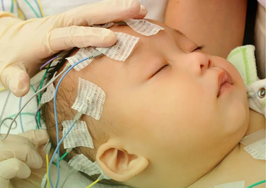 Eletroencefalograma (EEG)